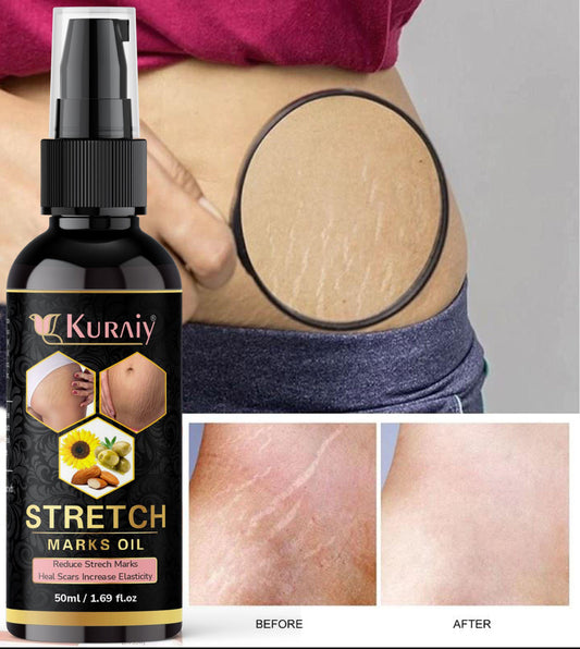 Kuraiy stretch Oil for Stretch Marks Removal Post Pregnancy fast work  result stretch mark cream oil  (50 ml)