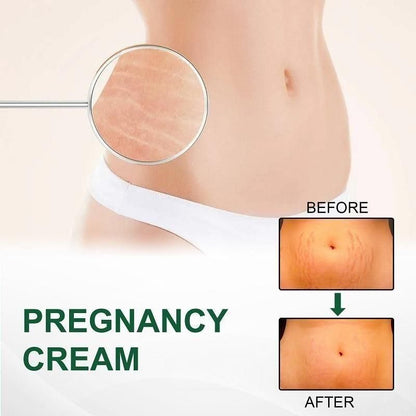 KURAI Pregnancy Scars, Acne Remove Cream